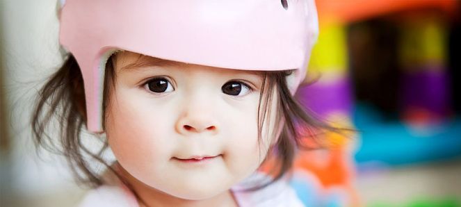 orthèse plagiocéphalie