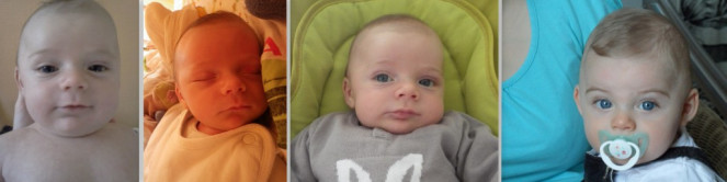 osthéopathie plagiocéphalie